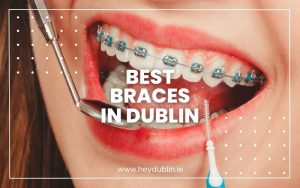 Best Braces in Dublin