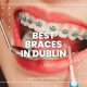 Best Braces in Dublin